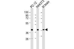 All lanes : Anti-Rnf2 Antibody (Center) at 1:2000 dilution Lane 1: PC-12 whole cell lysates Lane 2: NIH/3T3 whole cell lysates Lane 3: mouse brain lysates Lysates/proteins at 20 μg per lane. (RNF2 antibody  (AA 198-232))