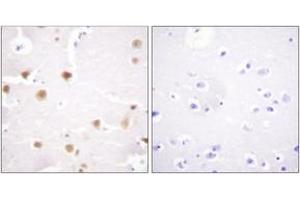 Immunohistochemistry (IHC) image for anti-Jun Proto-Oncogene (JUN) (AA 221-270) antibody (ABIN2888807) (C-JUN antibody  (AA 221-270))