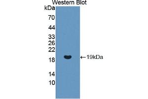 Detection of Recombinant REG3g, Human using Polyclonal Antibody to Regenerating Islet Derived Protein 3 Gamma (REG3g) (REG3g antibody  (AA 39-175))