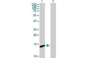 Western Blot analysis of CDA expression in transfected 293T cell line by CDA MaxPab polyclonal antibody.