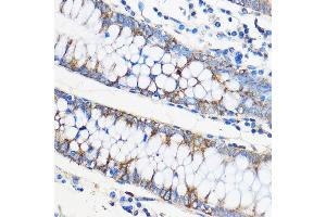 Immunohistochemistry of paraffin-embedded Human colon using ApoM Rabbit pAb (ABIN6127365, ABIN6137030, ABIN6137031 and ABIN6220968) at dilution of 1:50 (40x lens). (Apolipoprotein M antibody  (AA 23-188))