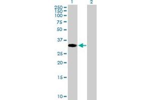 Western Blot analysis of ZNF101 expression in transfected 293T cell line by ZNF101 MaxPab polyclonal antibody. (ZNF101 antibody  (AA 1-316))