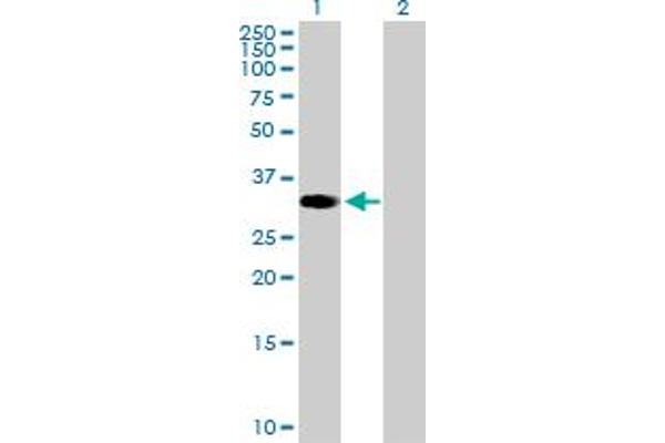ZNF101 antibody  (AA 1-316)