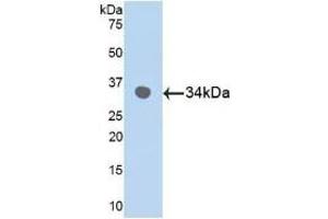 Detection of Recombinant MAPK9, Human using Polyclonal Antibody to Mitogen Activated Protein Kinase 9 (MAPK9) (JNK2 antibody  (AA 130-387))