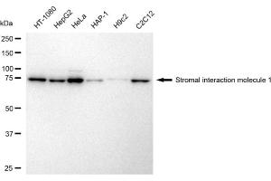 anti-Stromal Interaction Molecule 1 (STIM1) antibody