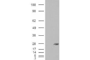 Western Blotting (WB) image for anti-SAR1 Homolog B (SAR1B) (Internal Region) antibody (ABIN2466238) (SAR1B antibody  (Internal Region))