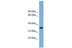 PRSS3 antibody used at 1 ug/ml to detect target protein. (PRSS3 antibody  (N-Term))