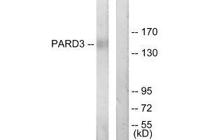 Western blot analysis of extracts from COLO205 cells, using PARD3 antibody.