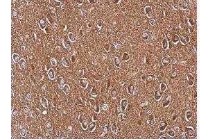 IHC-P Image Immunohistochemical analysis of paraffin-embedded CL1-5 xenograft, using AXL, antibody at 1:200 dilution. (AXL antibody  (C-Term))