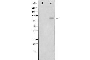 Western blot analysis of FRS2 expression in HUVEC whole cell lysates,The lane on the left is treated with the antigen-specific peptide. (FRS2 antibody  (C-Term))