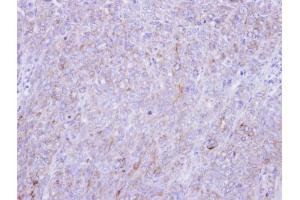 IHC-P Image Immunohistochemical analysis of paraffin-embedded DLD-1 xenograft, using Glypican-1, antibody at 1:100 dilution. (GPC1 antibody)