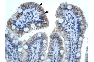 GJB1 antibody was used for immunohistochemistry at a concentration of 4-8 ug/ml to stain Epithelial cells of intestinal villus (lndicated with Arrows) in Human Intestine. (GJB1 antibody  (C-Term))