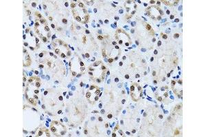 Immunohistochemistry of paraffin-embedded Rat kidney using CCAR2 Polyclonal Antibody at dilution of 1:100 (40x lens).