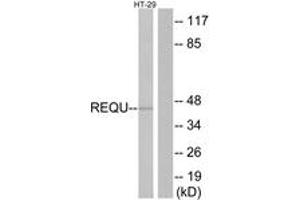 Western blot analysis of extracts from HT-29 cells, using REQU Antibody. (DPF2 antibody  (AA 151-200))