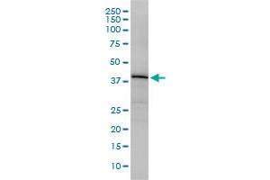 OBFC1 monoclonal antibody (M01), clone 3G12-1B7 Western Blot analysis of OBFC1 expression in Jurkat . (OBFC1 antibody  (AA 1-368))