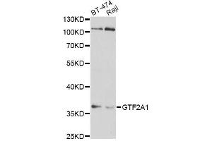 Western blot analysis of extracts of various cell lines, using GTF2A1 antibody (ABIN1876533) at 1:1000 dilution. (GTF2A1 antibody)