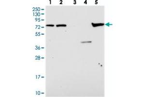Western blot analysis of Lane 1: RT-4, Lane 2: U-251 MG, Lane 3: Human Plasma, Lane 4: Liver, Lane 5: Tonsil with KBTBD8 polyclonal antibody . (KBTBD8 antibody)
