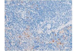 ABIN6267554 at 1/200 staining Mouse spleen tissue sections by IHC-P.