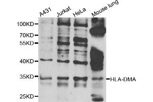 Western blot analysis of extracts of various cell lines, using HLA-DMA antibody (ABIN5975269) at 1/1000 dilution. (HLA-DMA antibody)