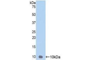Detection of Recombinant GROg, Human using Polyclonal Antibody to Chemokine (C-X-C Motif) Ligand 3 (CXCL3) (CXCL3 antibody  (AA 35-107))