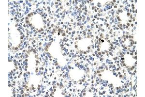 PRMT5 antibody was used for immunohistochemistry at a concentration of 4-8 ug/ml to stain Alveolar ceils (arrows) in Human Lung.