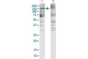Western Blotting (WB) image for anti-Collagen, Type V, alpha 2 (COL5A2) (AA 1-1139) antibody (ABIN1327031)