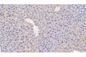 Immunohistochemistry (IHC) image for anti-Serpin Peptidase Inhibitor, Clade G (C1 Inhibitor), Member 1 (SERPING1) (AA 397-495) antibody (ABIN7438463)