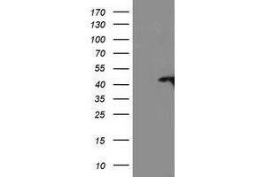 Western Blotting (WB) image for anti-TBC1 Domain Family, Member 21 (TBC1D21) antibody (ABIN1501312) (TBC1D21 antibody)