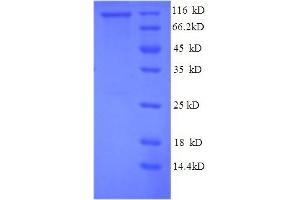 SDS-PAGE (SDS) image for phosphorylase, Glycogen, Liver (PYGL) (AA 2-846), (partial) protein (His tag) (ABIN4976464) (PYGL Protein (AA 2-846, partial) (His tag))