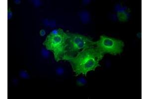 Immunofluorescence (IF) image for anti-Fermitin Family Member 2 (FERMT2) antibody (ABIN1499049) (FERMT2 antibody)