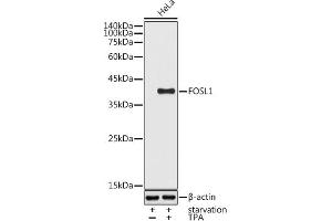 Western blot analysis of extracts of HeLa cells, using FOSL1 antibody (ABIN6131653, ABIN6140738, ABIN6140739 and ABIN6221016) at 1:1000 dilution. (FOSL1 antibody  (AA 1-100))