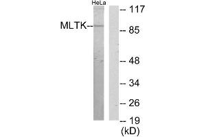 Western Blotting (WB) image for anti-Mitogen-Activated Protein Kinase Kinase Kinase MLT (ZAK) (C-Term) antibody (ABIN1850019) (ZAK antibody  (C-Term))