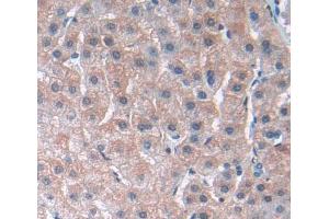 Used in DAB staining on fromalin fixed paraffin- embedded liver tissue (PLA2G3 antibody  (AA 20-268))