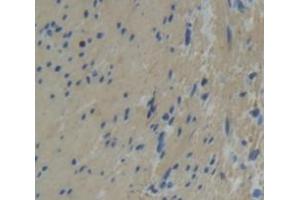 Figure. (Tropomodulin 1 antibody  (AA 39-138))