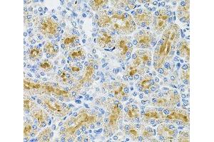 Immunohistochemistry of paraffin-embedded Rat kidney using DDX20 Polyclonal Antibody at dilution of 1:100 (40x lens). (DDX20 antibody)