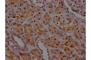IHC image of ABIN7127662 diluted at 1:100 and staining in paraffin-embedded human kidney tissue performed on a Leica BondTM system. (Recombinant PAI1 antibody)