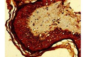 Immunohistochemistry of paraffin-embedded human skin tissue using ABIN7167795 at dilution of 1:100 (Retinoic Acid Early Transcript 1E (RAET1E) (AA 31-225) antibody)