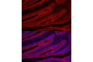 Immunofluorescence analysis of human colon carcinoma using TFF3 Rabbit pAb (ABIN6128142, ABIN6149051, ABIN6149052 and ABIN6219136) at dilution of 1:100 (40x lens). (TFF3 antibody  (AA 22-94))