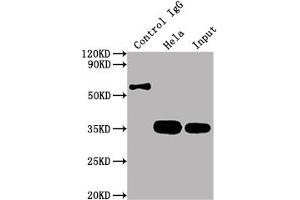 Immunoprecipitating CDK4 in Hela whole cell lysate Lane 1: Rabbit control IgG instead of ABIN7127418 in Hela whole cell lysate. (Recombinant CDK4 antibody)