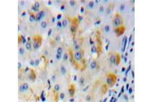 IHC-P analysis of Liver tissue, with DAB staining. (MMP15 antibody  (AA 336-539))