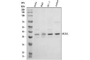 Western blot analysis of IKB Alpha/NFKBIA using anti-IKB Alpha/NFKBIA antibody (ABIN3043889).