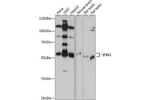 Western blot analysis of extracts of various cell lines, using IP6K1 antibody (ABIN6131922, ABIN6142500, ABIN6142501 and ABIN6215821) at 1:1000 dilution. (IP6K1 antibody  (AA 1-220))