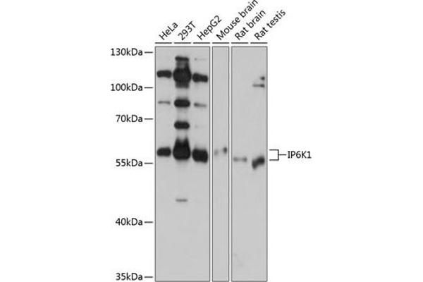IP6K1 抗体  (AA 1-220)