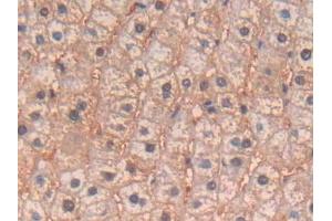 DAB staining on IHC-P; Samples: Human Liver Tissue (IL-4 antibody  (AA 25-153))