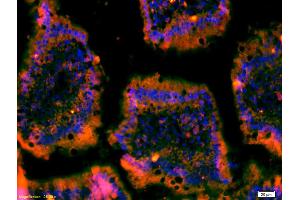 Formalin-fixed and paraffin-embedded mouse intestine labeled with Anti-C-Met/Met/HGFR Polyclonal Antibody, Unconjugated (ABIN671661) 1:200, overnight at 4°C, The secondary antibody was Goat Anti-Rabbit IgG, Cy3 conjugated used at 1:200 dilution for 40 minutes at 37°C. (c-MET antibody  (AA 25-150))