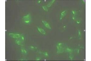 Immunofluorescence staining of human LNCap cell colony with monoclonal anti- human STEAP1 antibody. (STEAP1 antibody  (AA 1-70))