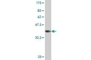 Western Blot detection against Immunogen (38. (ADK antibody  (AA 236-345))