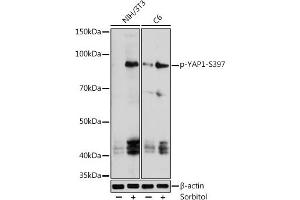 Western blot analysis of extracts of various cell lines, using phospho-Y-S397 antibody (ABIN7271417) at 1:1000 dilution. (YAP1 antibody  (pSer397))
