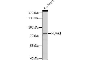 Western blot analysis of extracts of rat heart, using NU antibody (ABIN7268966) at 1:1000 dilution. (NUAK1 antibody  (AA 362-661))