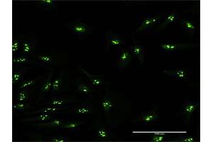 Immunofluorescence of purified MaxPab antibody to KIAA0020 on HeLa cell. (KIAA0020 antibody  (AA 1-648))